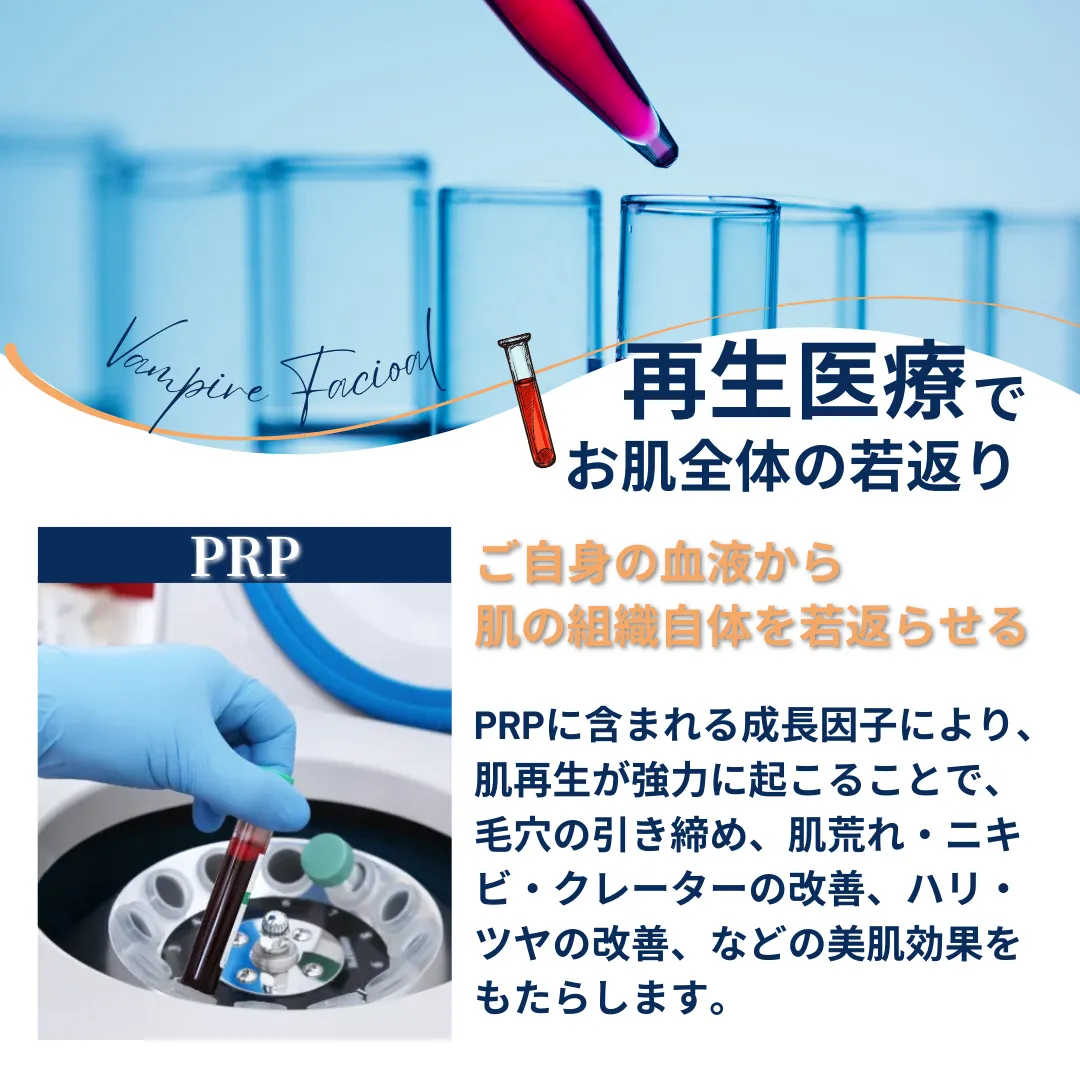 男だって肌メンテ　ニキビ跡・クレーター肌改善　ご自身の血液を使った再生医療　ヴァンパイアフェイシャル　美容初心者OK!!